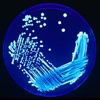 Legionella bacteria